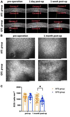 Comparisons of the clinical outcomes of Centurion® active fluidics system with a low IOP setting and gravity fluidics system with a normal IOP setting for cataract patients with low corneal endothelial cell density